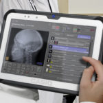 Casio Tablet V-T500: Besprechung der Röntgenaufnahme am Patientenbett